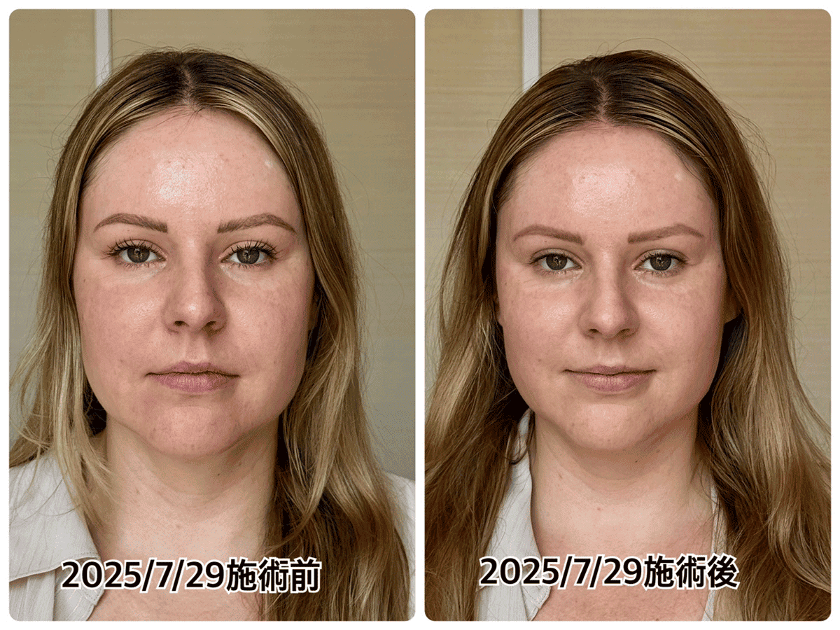Before/After 1