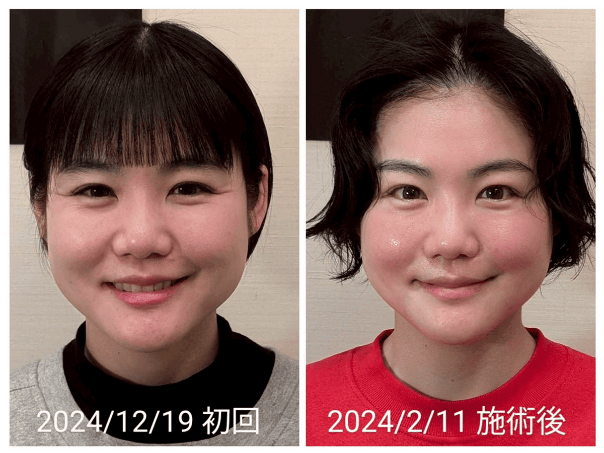 Before/After 3
