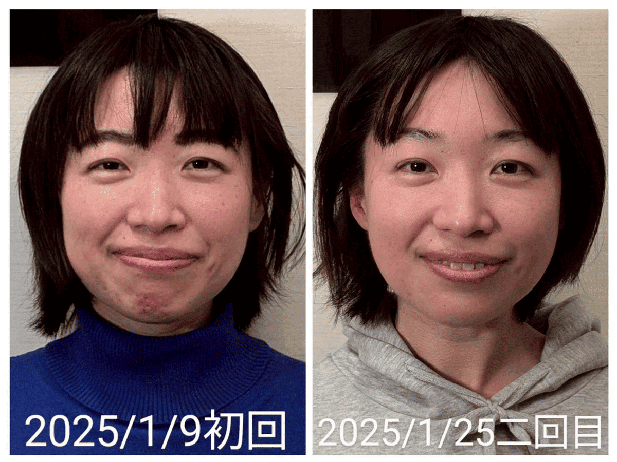 Before/After 4