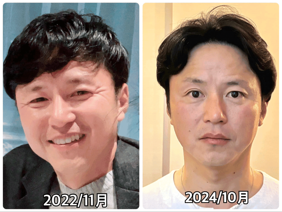 Before/After 5