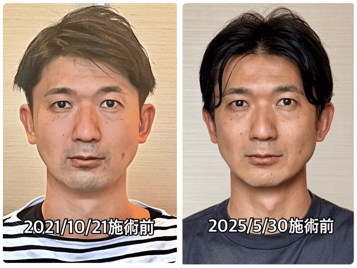 Before/After 6