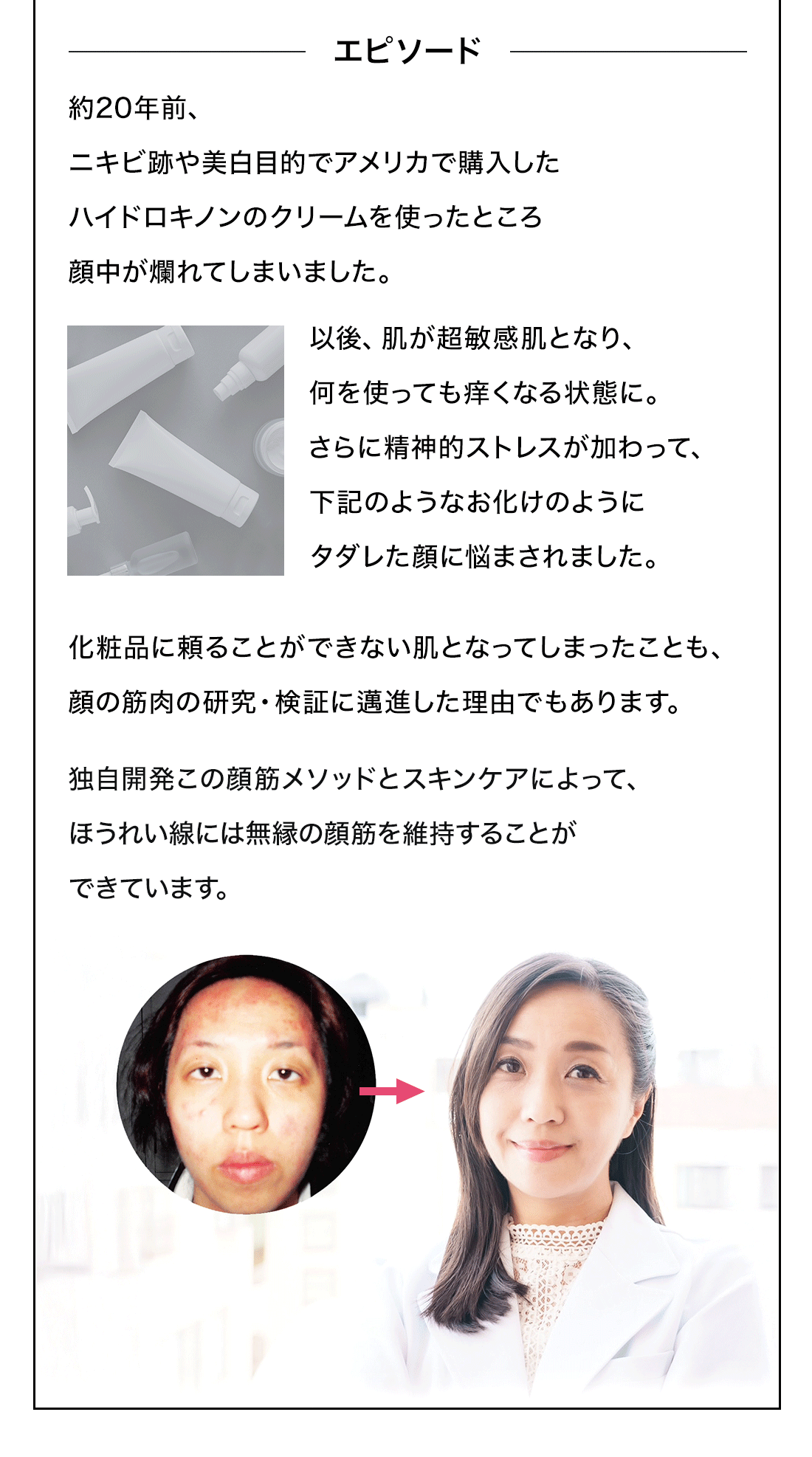 エピソード